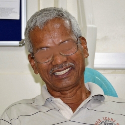 dental implant fixture with prosthesis akurdi