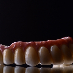 Dental Impressions for Implant Crowns