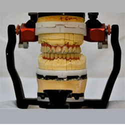 ready for definitive crown