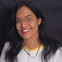 laminates in pradhikaran simple and effective 6 step procedure