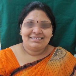 pre operative frontal view dental case assessment