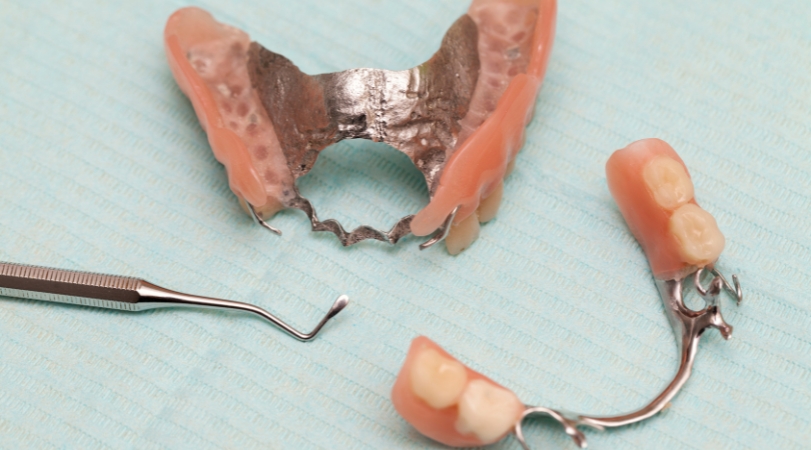 Maxillofacial Prostheses in Pune – Restorative Expertise
