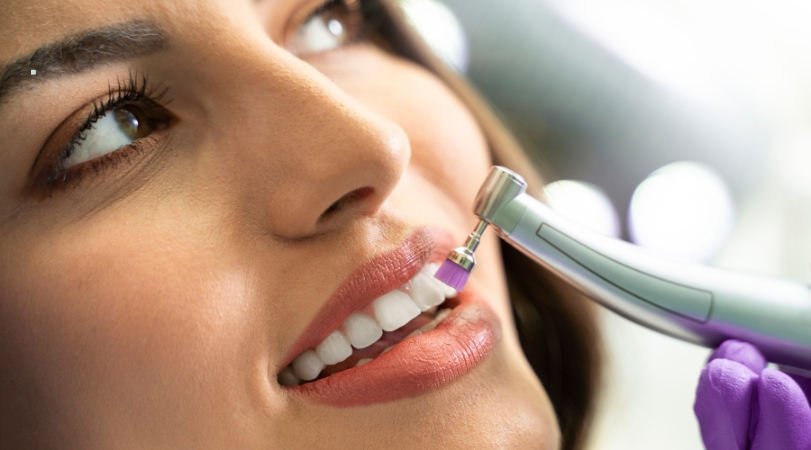 Scaling & Polishing in Ravet – Professional Dental Cleaning