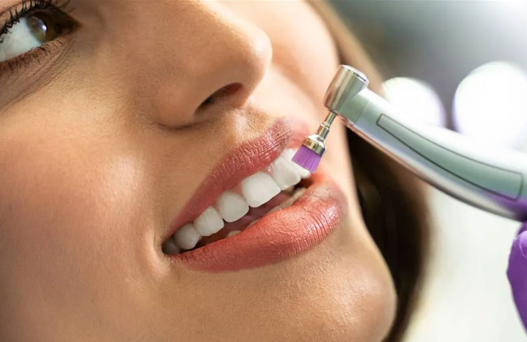 Scaling & Polishing in Akurdi and Pune – Bright & Healthy Smiles